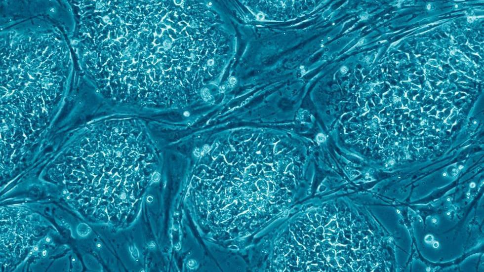 Embryonic stem cells. Image: PLoS Biology / Nissim Benvenisty under Creative Commons licence