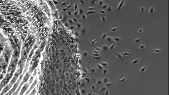 Cells migrating off a fish scale © 2014 EPFL