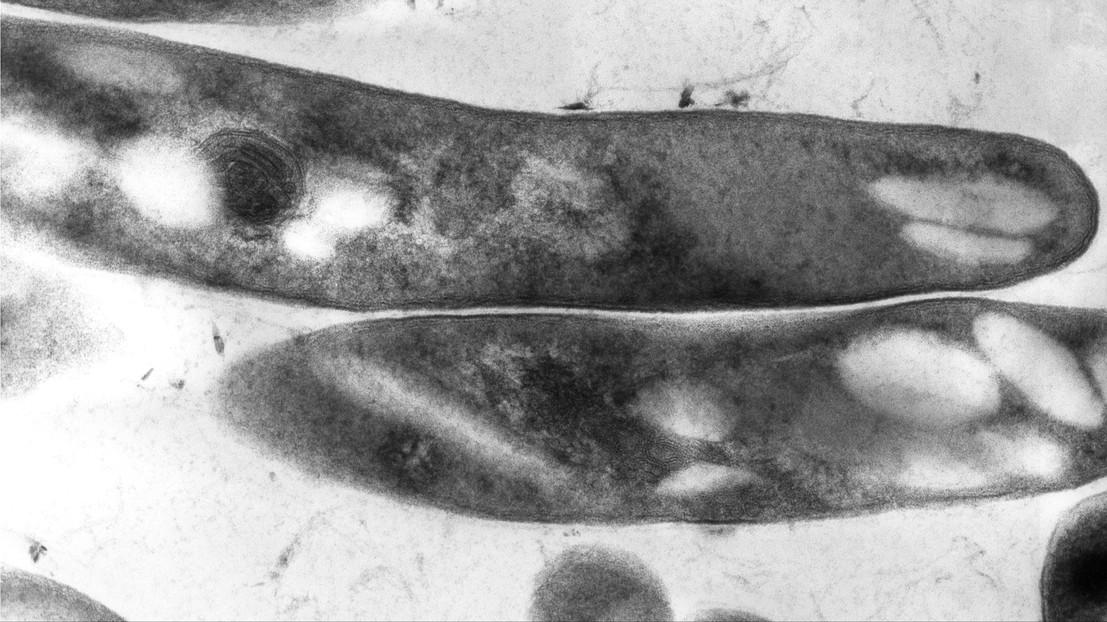 Mycobacterium tuberculosis (credit à CDC/Elizabeth "Libby" White)