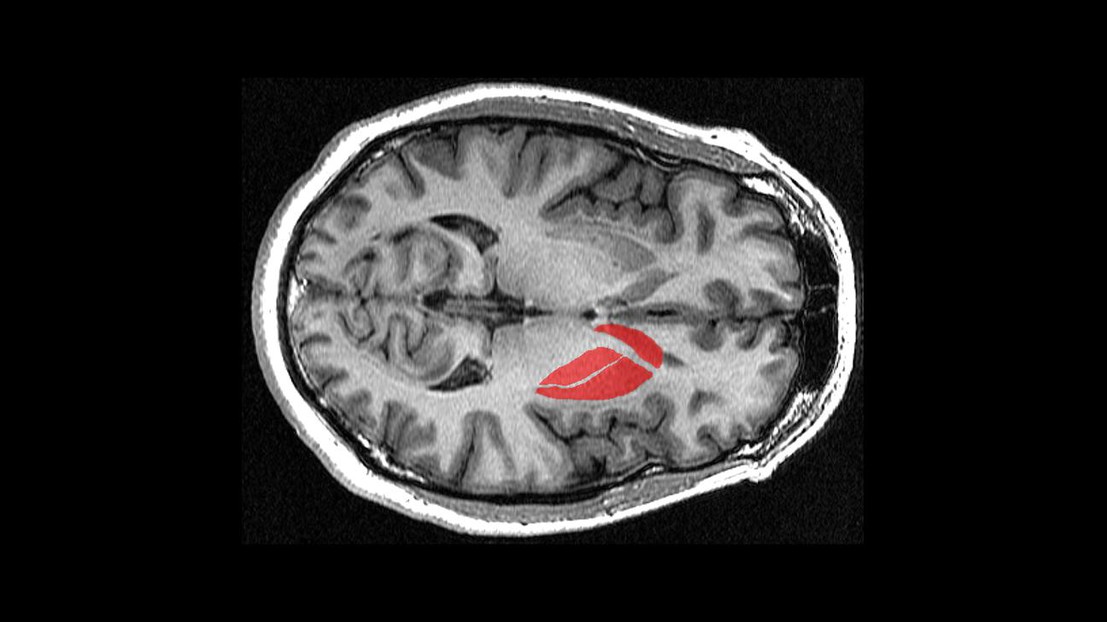 MRI image of the striatum (Credit: Lindsay Hanford, Geoff B Hall/Wikimedia Commons)