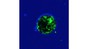 Vibrio cholerae in amoebal cyst ©Melanie Blokesch/EPFL