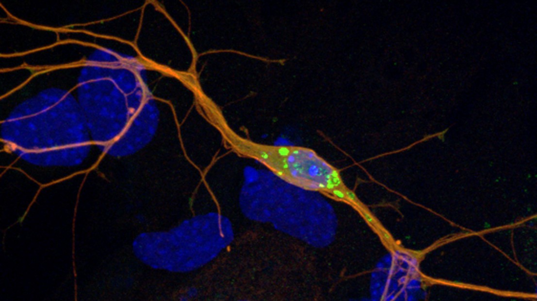 Des corps de Lewy dans un neurone © M. Fares (EPFL)