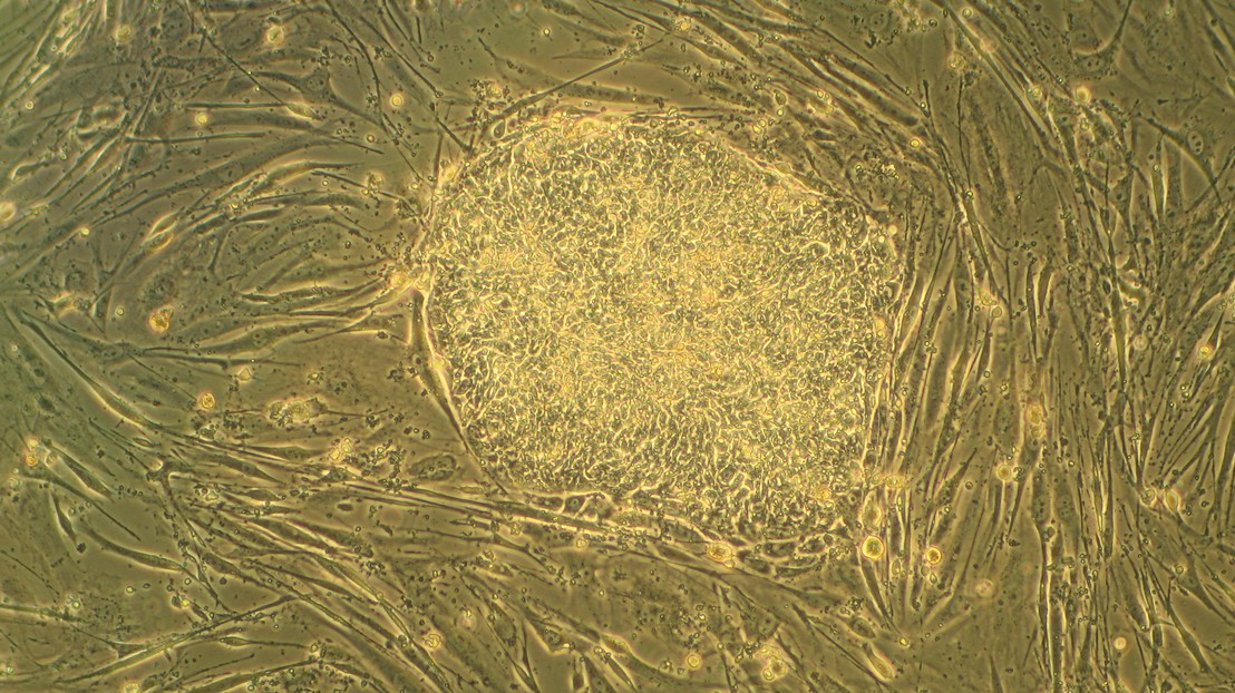 Une colonie de cellules souches embryonnaires, entourée par des fibroblastes (Wikipedia | Commons)