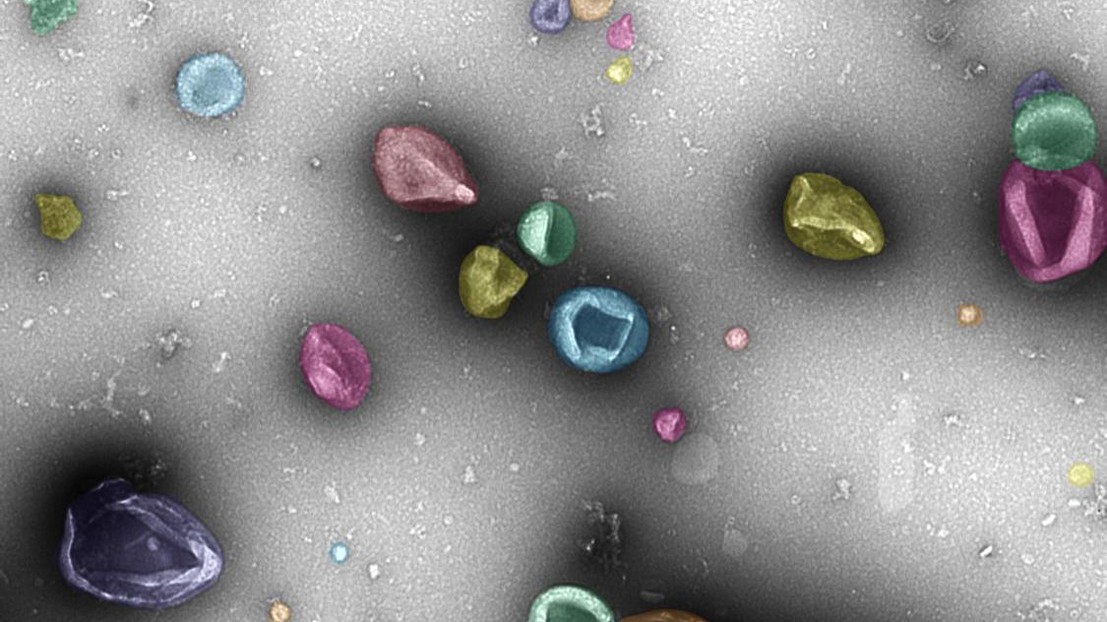 Image microscopique électronique des exosomes sécrétés par les cellules pancréatiques © S. Baekkeskov / EPFL