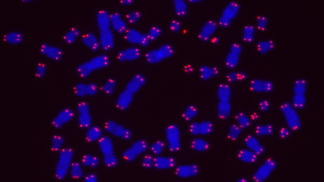 Metaphase chromosomes (blue) of human cancer cells (HeLa) with their telomeres stained in red. Credit: A. Vancevska/J. Lingner (EPFL)