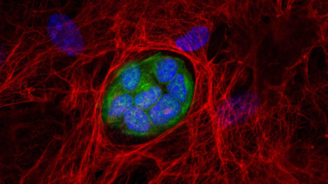 Breast cancer cells (green) find their niche in a periostin (red) micro-environment. © ISREC / EPFL