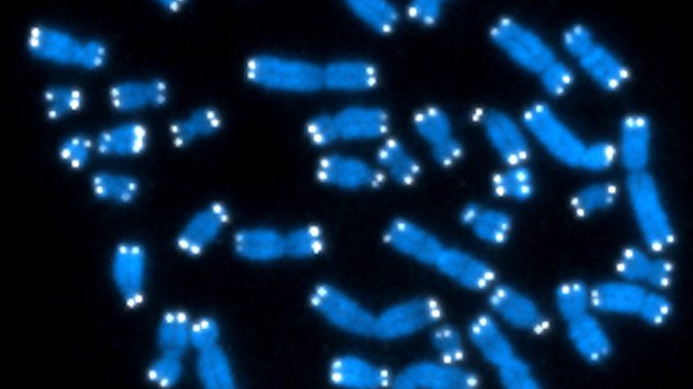 The telomeres can be seen as white dots on these chromosomes© National Institute of Health