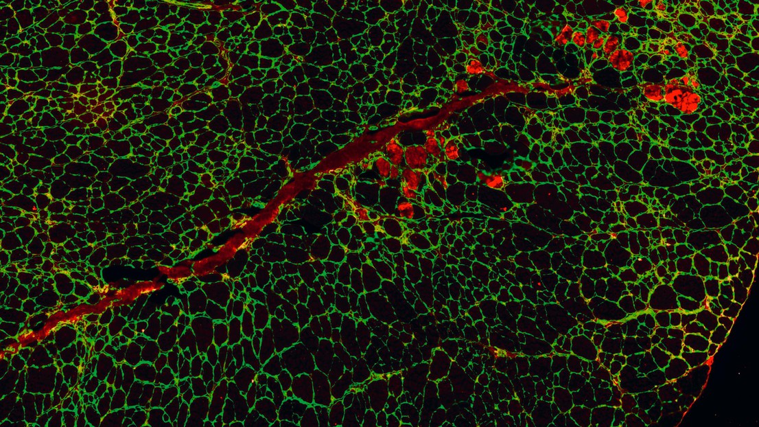 Regenerating muscle cells thanks to Urolithin A. © Amazentis / EPFL Auwerx Lab