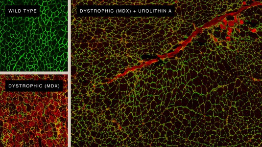 Comparison: sound muscle cells, dystrophic muscle cells, Urolithin A-treated muscle cells.