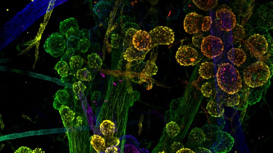 Code couleur temporel 3D des cellules myoépithéliales dans un spécimen de sein humain © Patrick Aouad / EPFL