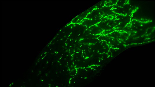 Micrographie stéréoscopique en fluorescence d’une glande mammaire de souris injectée par voie intraductale avec des cellules épithéliales mammaires humaines normales © Marie Shamseddin / EPFL
