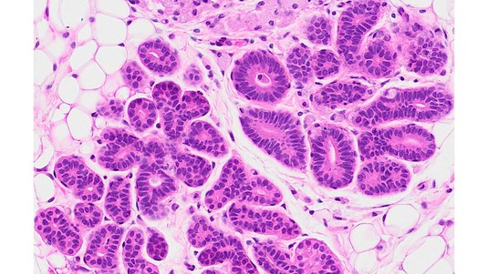 Coupe histologique colorée à l'hématoxyline et à l'éosine montrant des cellules épithéliales primaires du sein humain greffées dans les canaux lactifères de la souris © Fabio De Martino / EPFL