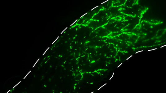Fluoreszenzmikroskopische Aufnahme einer intraduktal mit normalen menschlichen Brustepithelzellen injizierten Mammadrüse einer Maus © Marie Shamseddin / EPFL