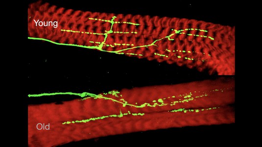Adult Drosophila motor terminals (green) and muscles (red) in young (above) and old (below) animals. © Laboratory of Neural Genetics and Disease / EPFL