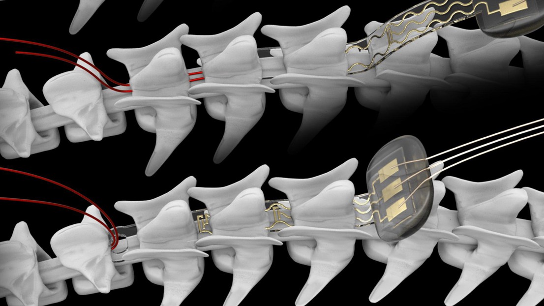 L'implant souple se glisse entre les vertèbres et la moelle épinière. © LSBI / EPFL 2021