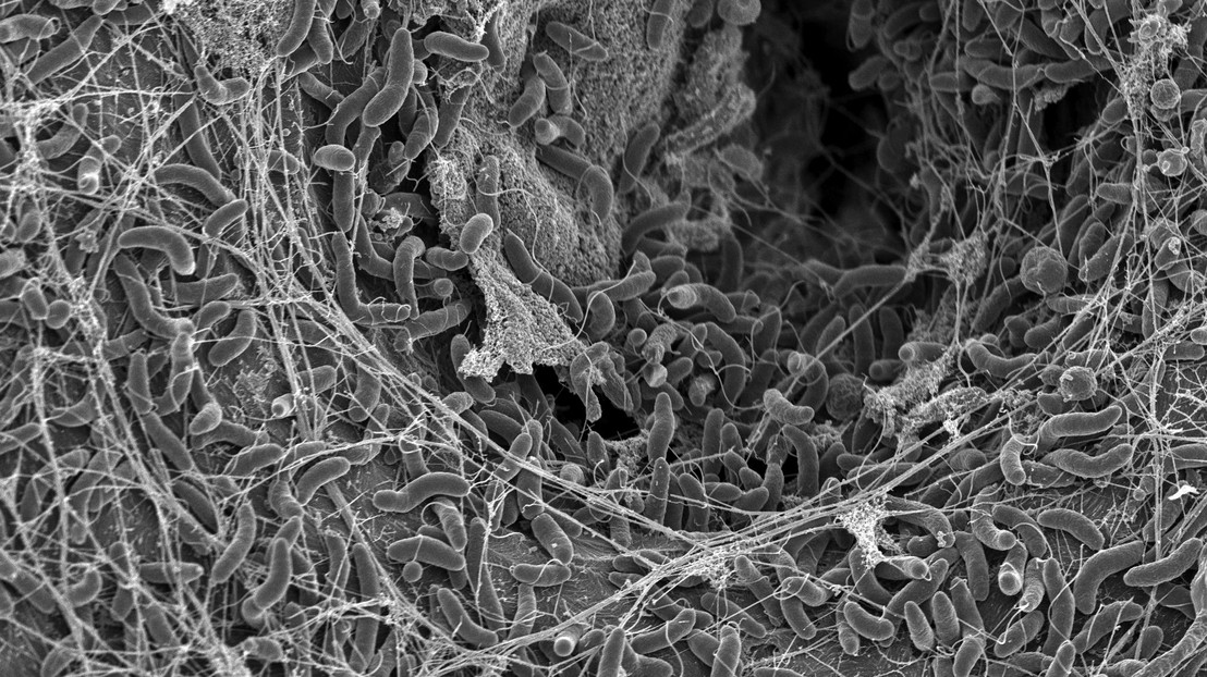 Scanning Electron Microscope photograph of V. cholerae bacteria. Credit: G. Knott, M. Blokesch, EPFL