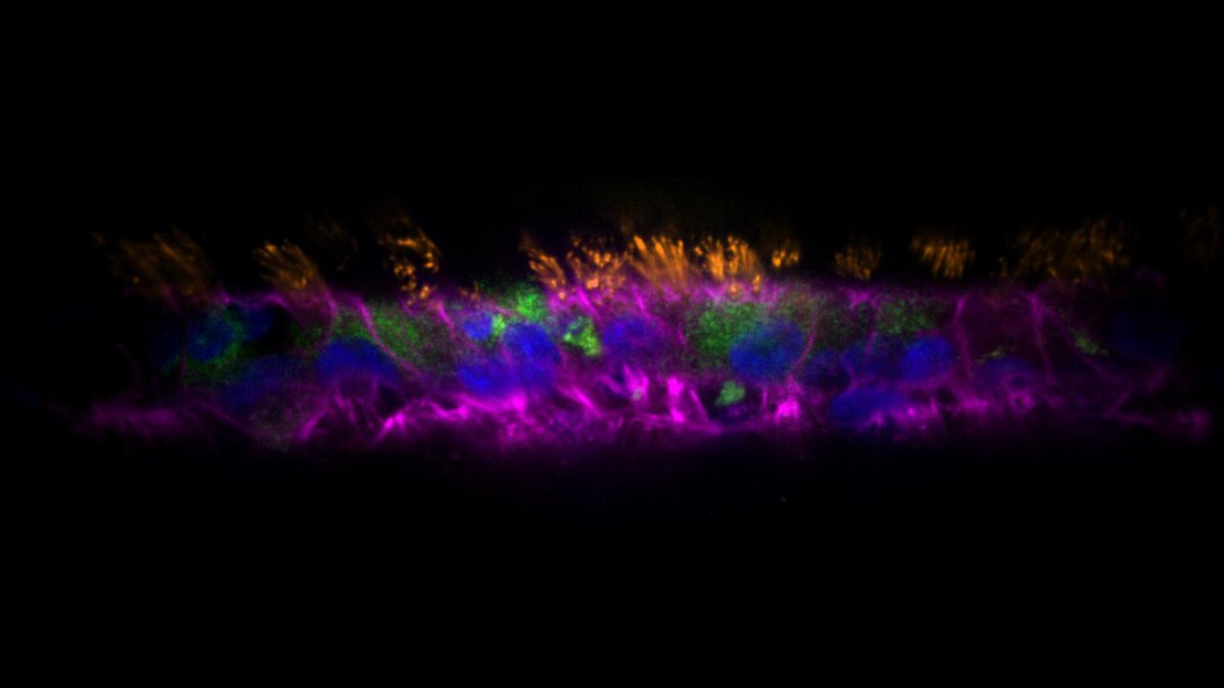 Human airway epithelial cells after growth and differentiation inside an AirGel tissue-engineered airway. Green: mucus; orange: cilia; pink: actin; blue: nuclei. Credit: Tamara Rossy (EPFL)