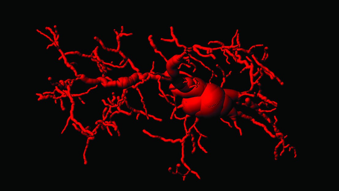 Cellule de microglie activée dans le cerveau de souris activées par cGAS/STING. © 2023 EPFL/ Gulen et al. Nature 02  August 2023. DOI: 10.1038/s41586-023-06373-1 (0)- CC-BY-SA 4.0