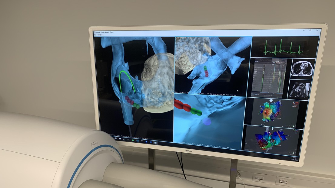 Cardiac intervention simulator - 2023 EPFL/ Unknown- CC-BY-SA 4.0