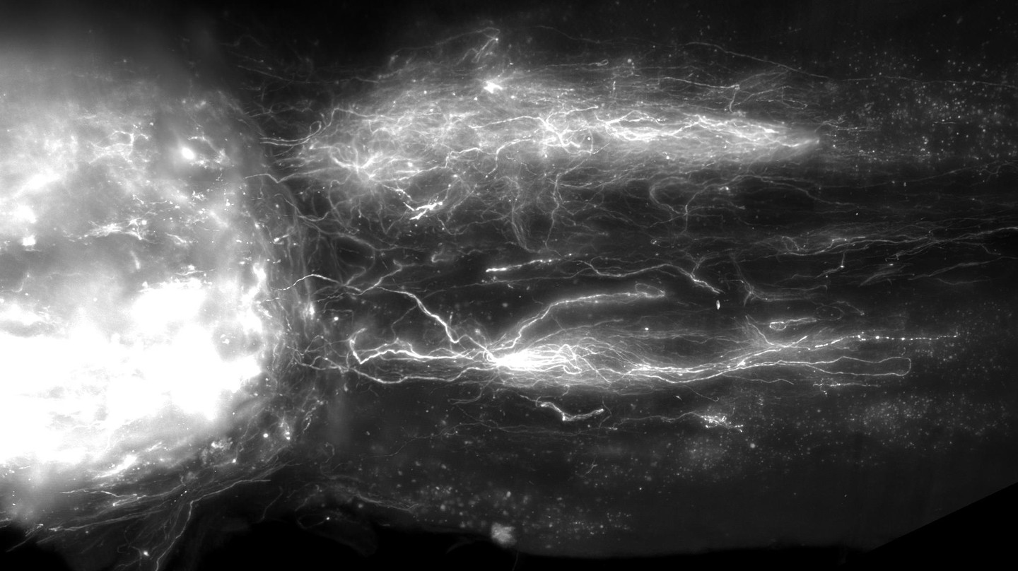 Whole spinal cord visualization of regenerating projections. EPFL / .Neurorestore