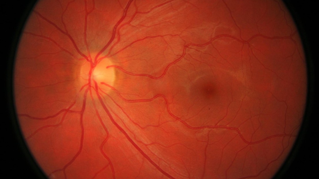 © photos.com © photos.com