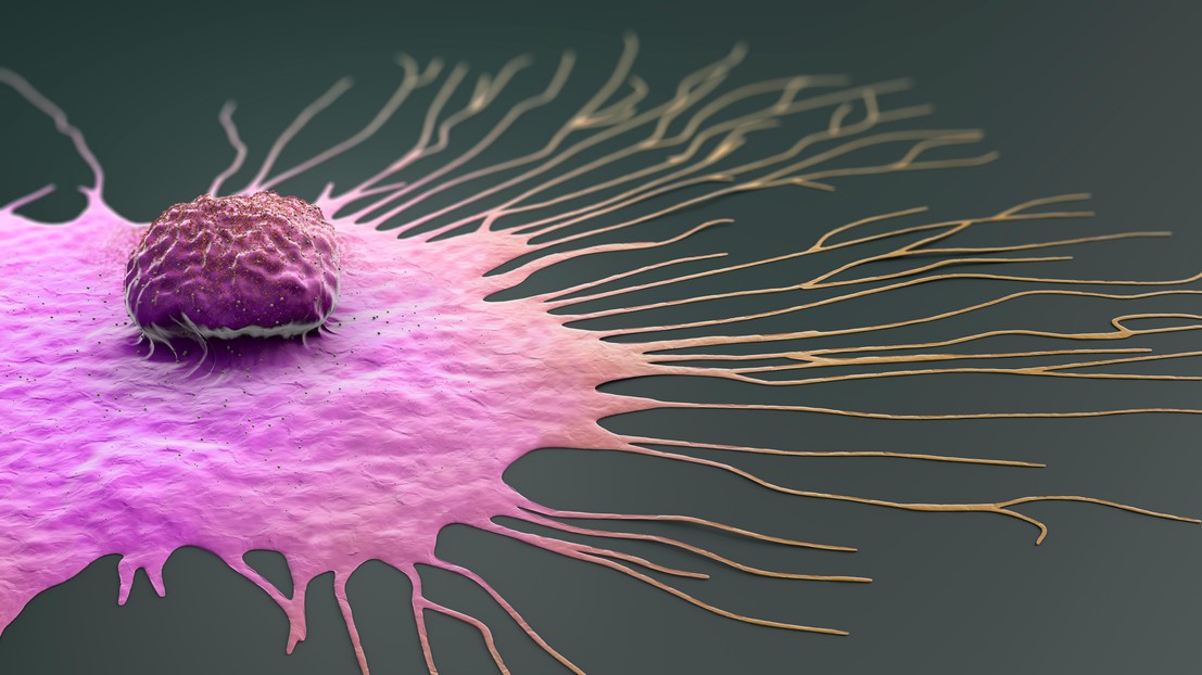 Cellule de cancer du sein en migration © EPFL/iStock photos (Christoph Burgstedt)