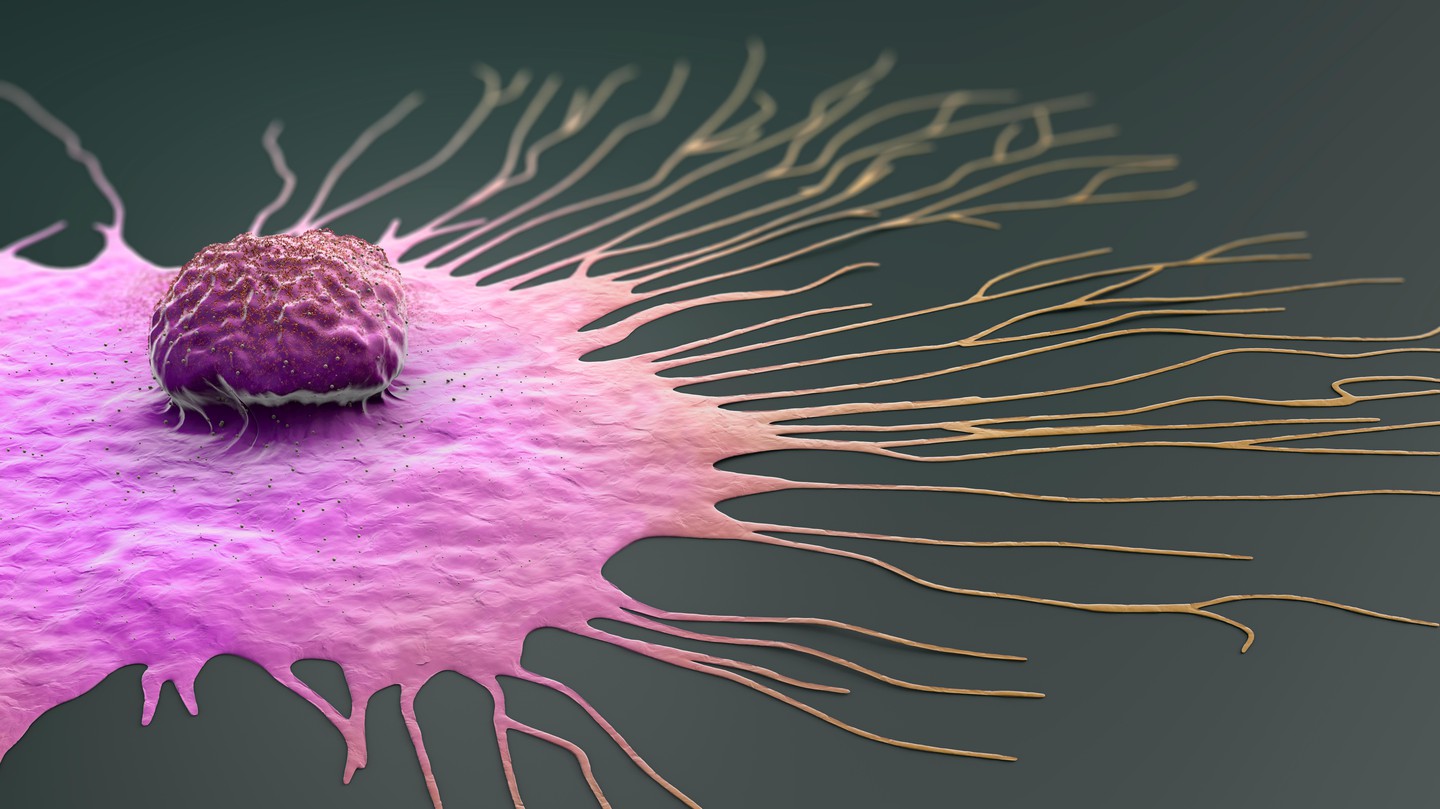 A migrating breast cancer cell © EPFL/iStock photos (Christoph Burgstedt)