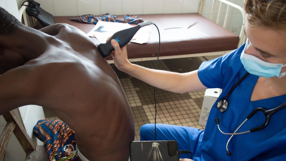 AIがサブサハラアフリカでの結核診断を支援(AI making it easier to diagnose tuberculosis in sub-Saharan Africa)