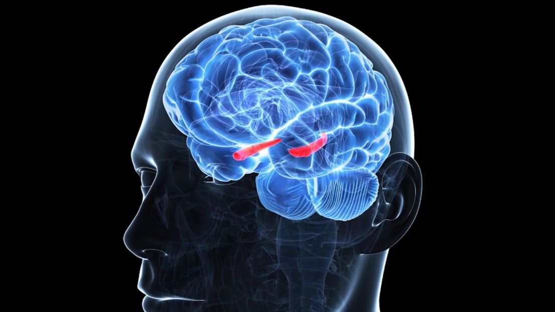 © 2025 EPFL Amnesic patient showed bilateral atrophy of hippocampus caused by infection