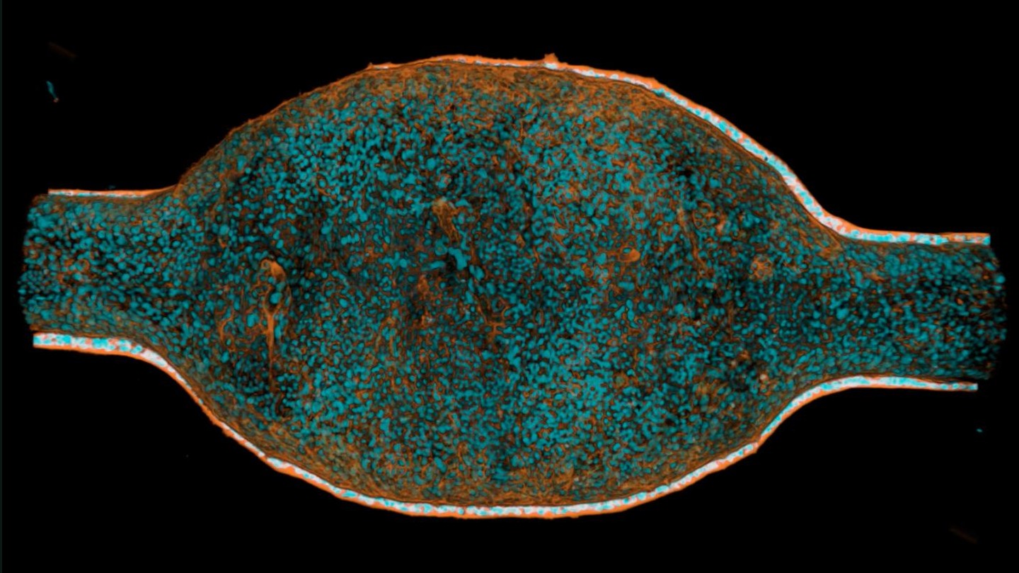 Animated Z-stack showing a volume of a differentiated mini-bladder stained with phalloidin (orange) and DAPI (cyan). Credit: Paduthol et al 2026.