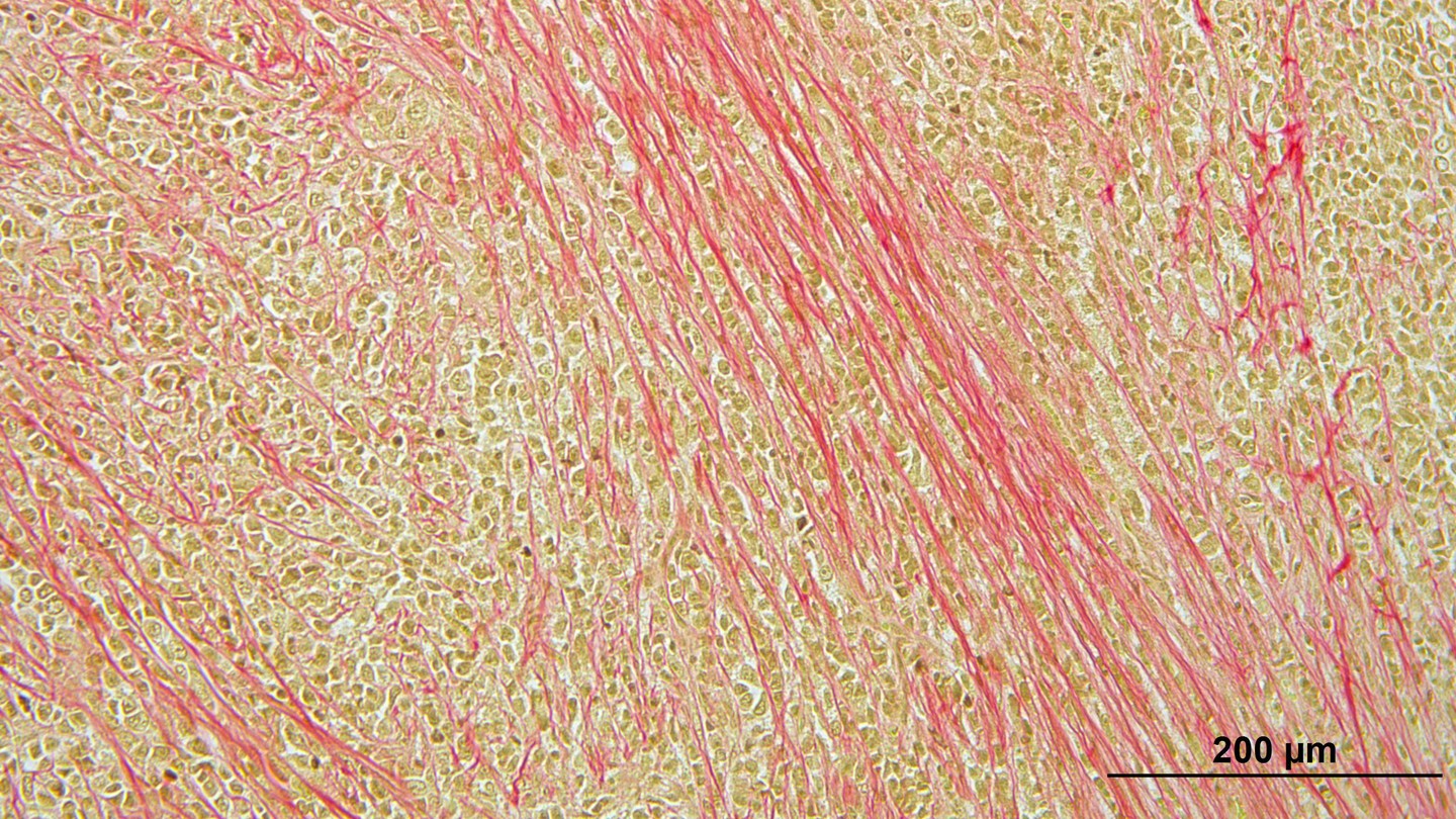Modèle préclinique en laboratoire du sous-type histologique le plus courant du cancer du sein. 2026 EPFL/George Sflomos CC-BY-SA 4.0