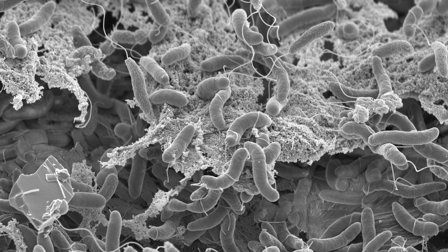 Vibrio cholerae on a chitinous surface. Photo taken with a Scanning Electron Microscope. Credit: Graham Knott and Melanie Blokesch © 2026 EPFL