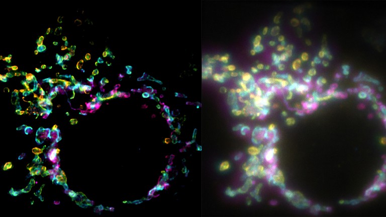 Mitochondrial outer membrane imaged with SPIFFI (left) versus widefield microscopy (right). EPFL CC BY SA – 4.0