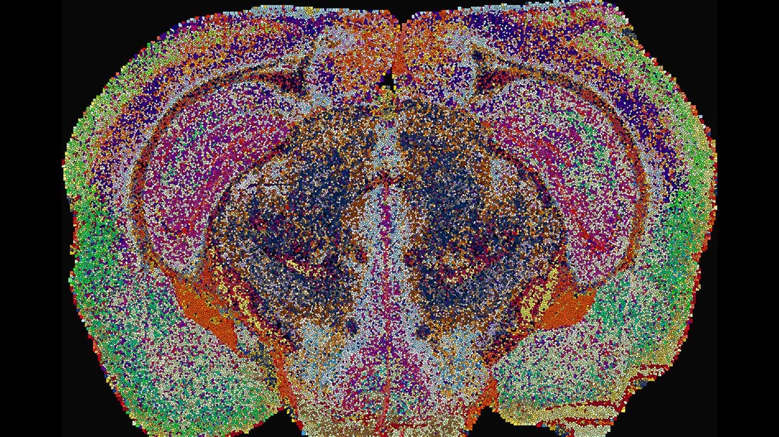 Lipizones in the mouse brain, determined by MALDI-MSI. Dots are enlarged for visualization purposes. Credit: 2026 EPFL/Luca Fusar Bassini - CC-BY-SA 4.0