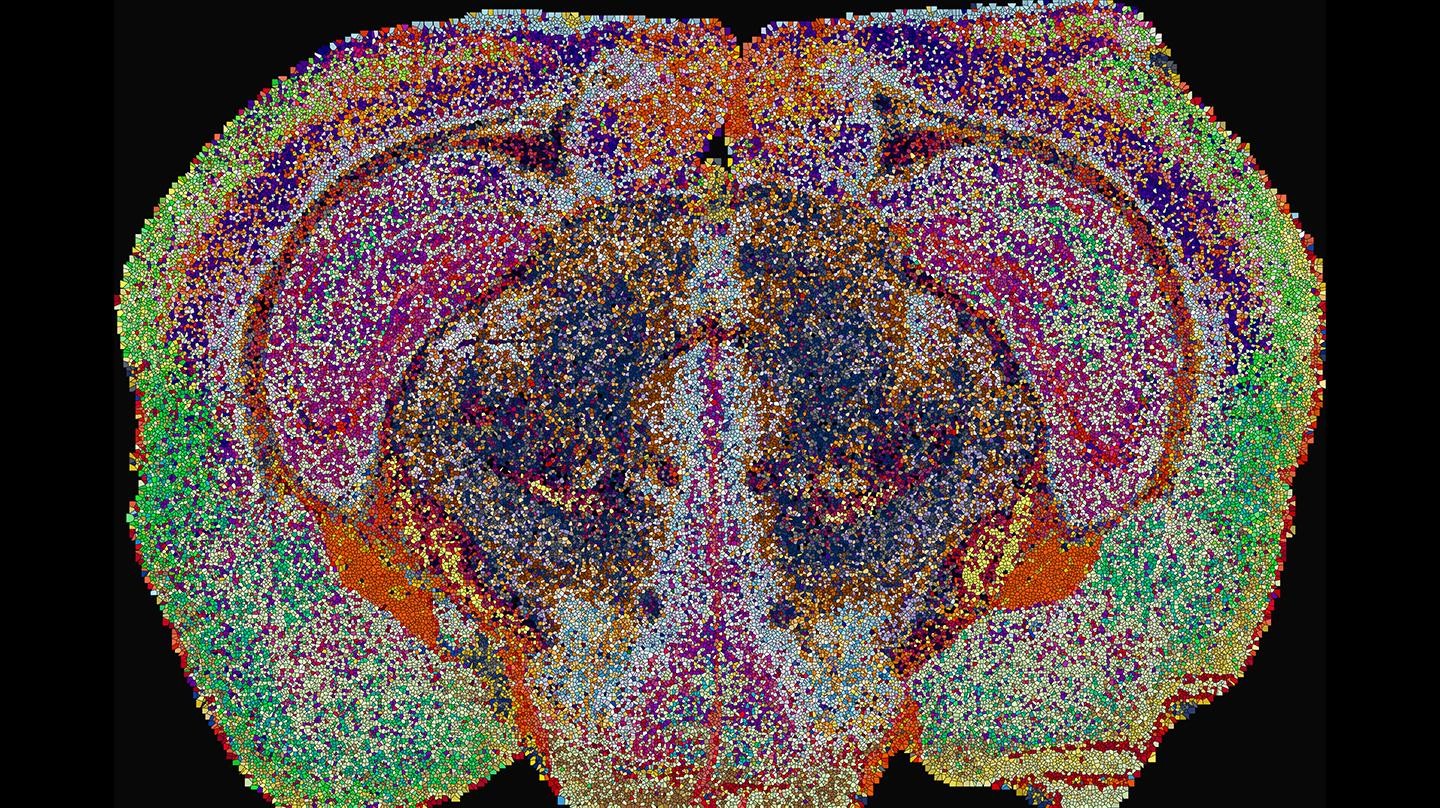 Lipizones dans le cerveau de souris, déterminées par MALDI-MSI. Les points sont agrandis à des fins de visualisation. Crédit : 2026 EPFL/Luca Fusar Bassini - CC-BY-SA 4.0