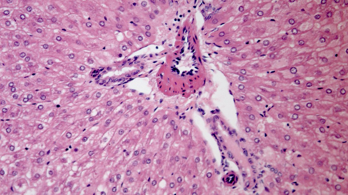 Liver cells under the microscope. © photos.com
