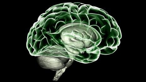 © 2014 EPFL © 2014 EPFL