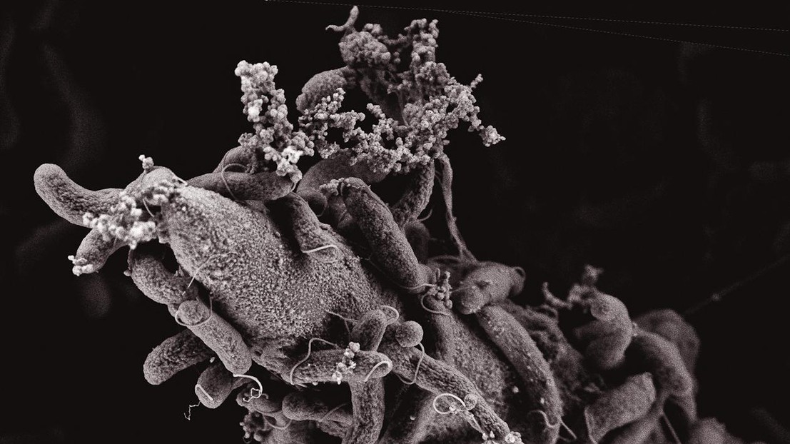 Vibrio cholerae bacteria on a chitin surface ©Graham Knott & Melanie Blokesch/EPFL