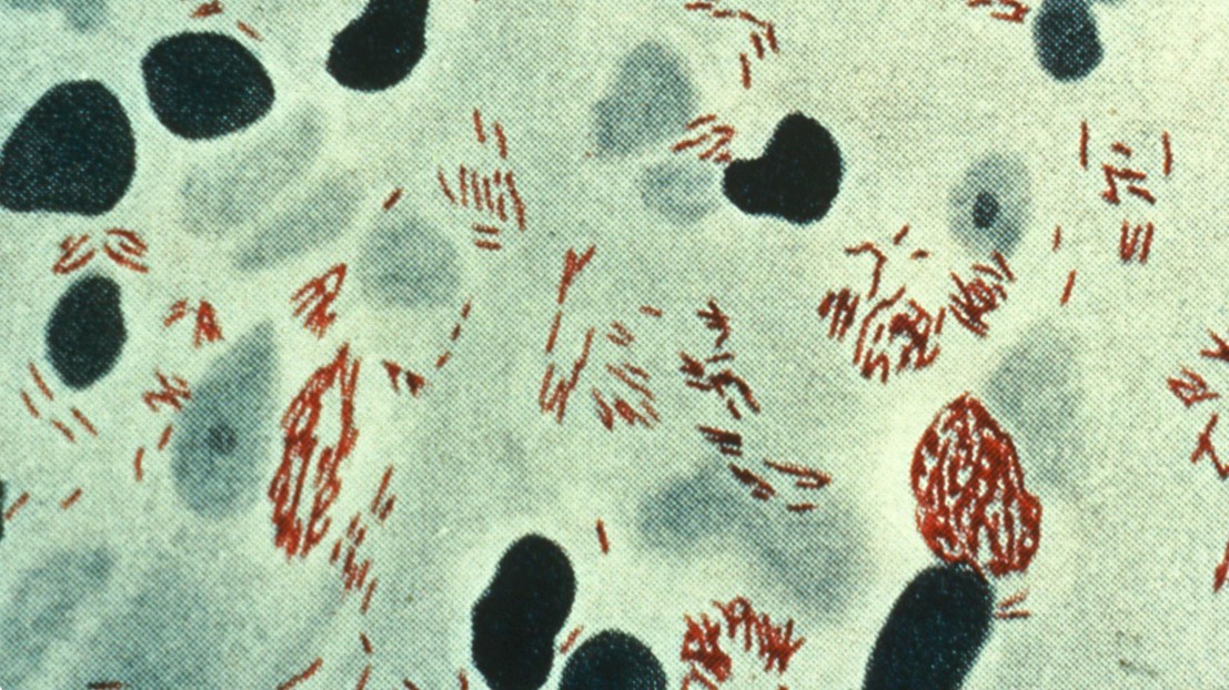 Mycobacterium leprae (rouge) ©CDC