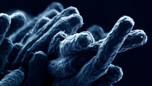 M. tuberculosis © Andrea Ablasser/EPFL
