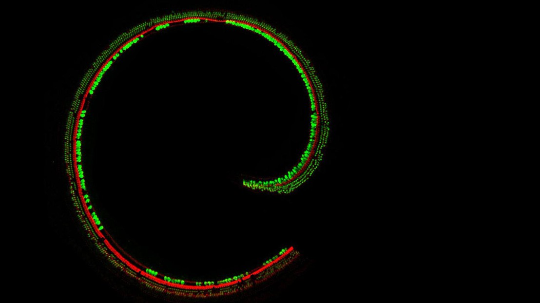 Sensory hair cells in the cochlea (image: Charles Askew)