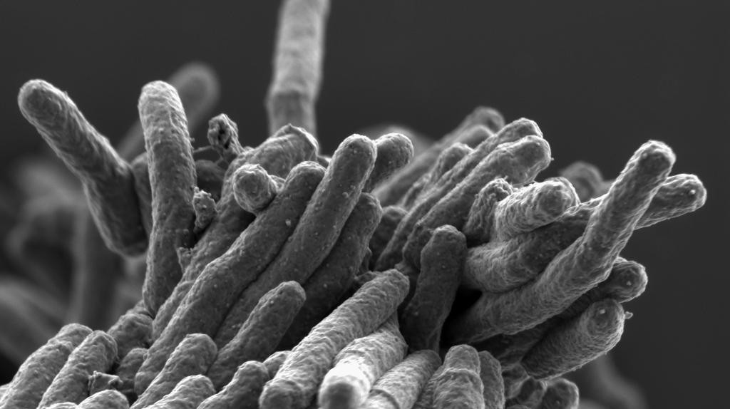 Mycobacterium tuberculosis ©Stewart Cole/EPFL