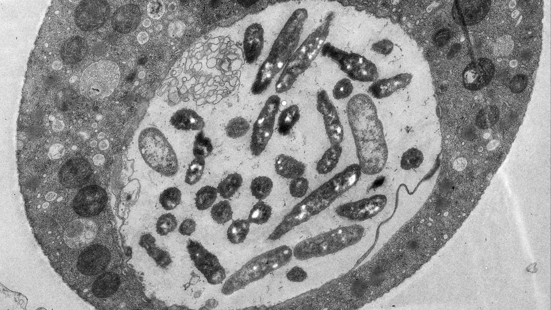 Vibrio cholerae bacteria inside the water-discharge vacuole of an amoeba © Melanie Blokesch/EPFL