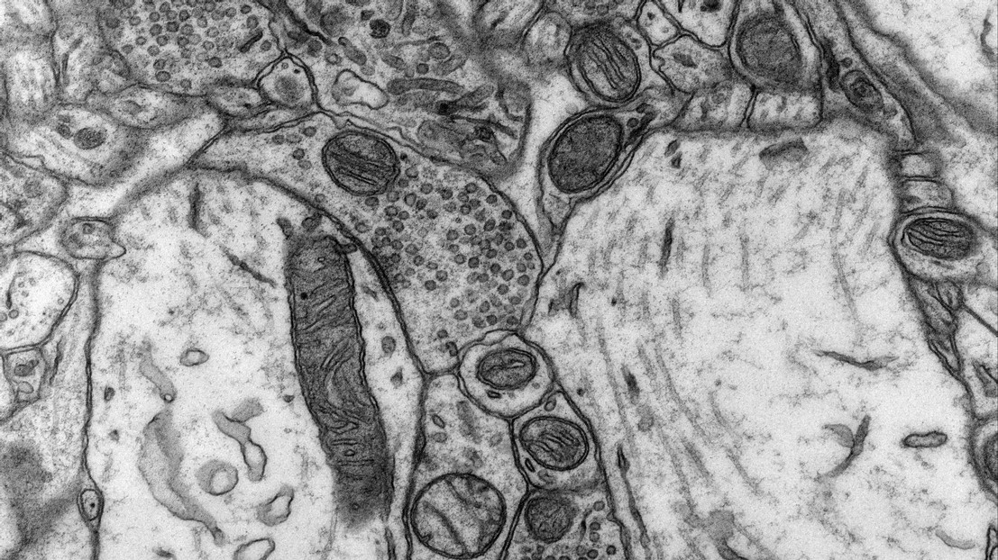 Les mitochondries dans les neurones du nucleus accumbens © Graham Knott (EPFL)