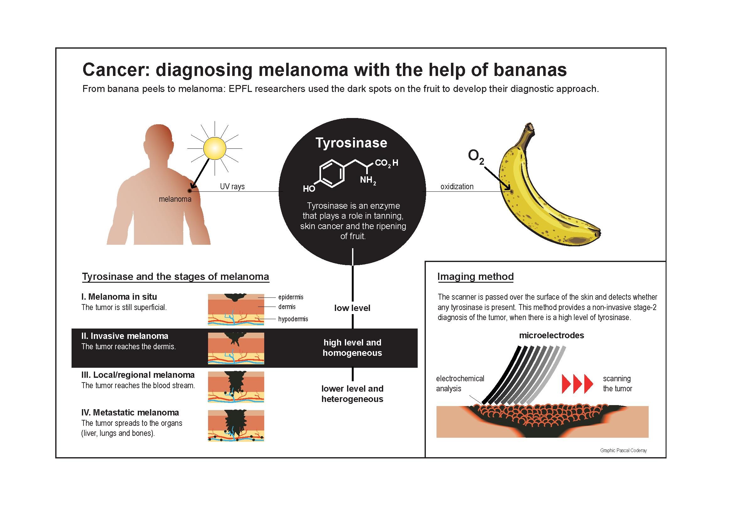 Cancer Banana Peels Can Help Identify The Stages Of Melanoma Epfl