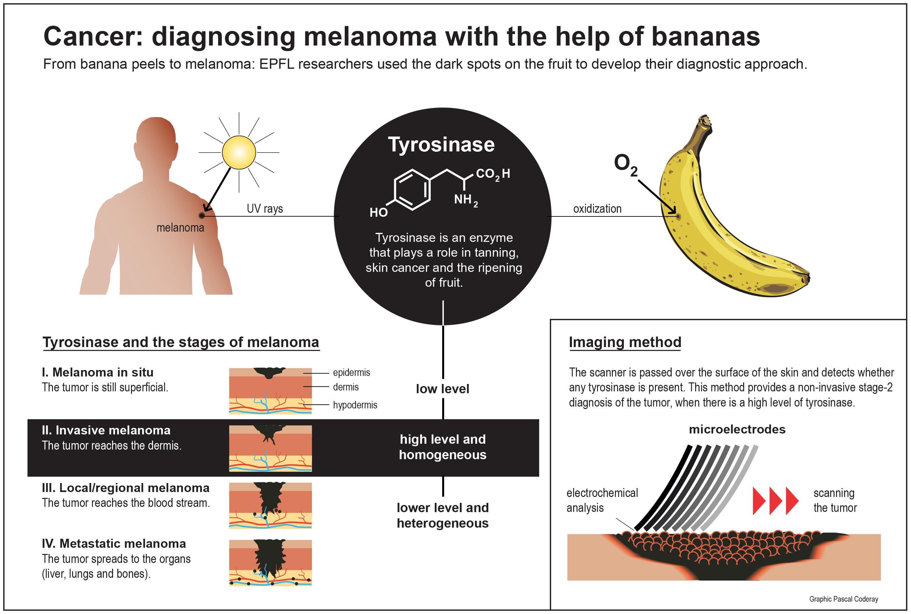 Cancer Banana Peels Can Help Identify The Stages Of Melanoma Epfl