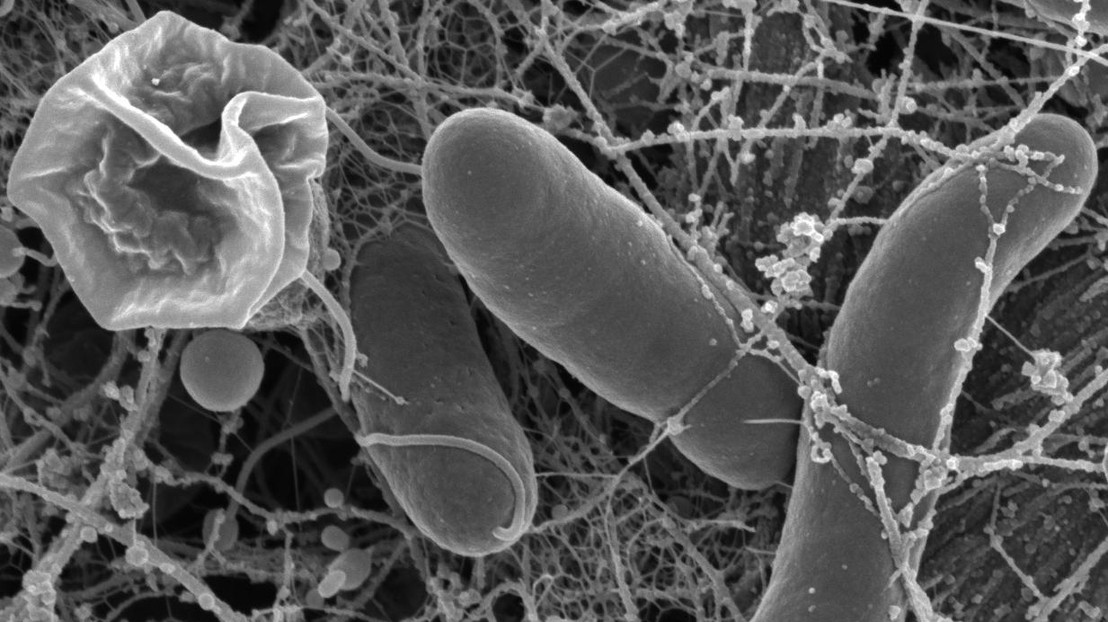 Vibrio cholerae growing on chitin © Melanie Blokesch/EPFL  