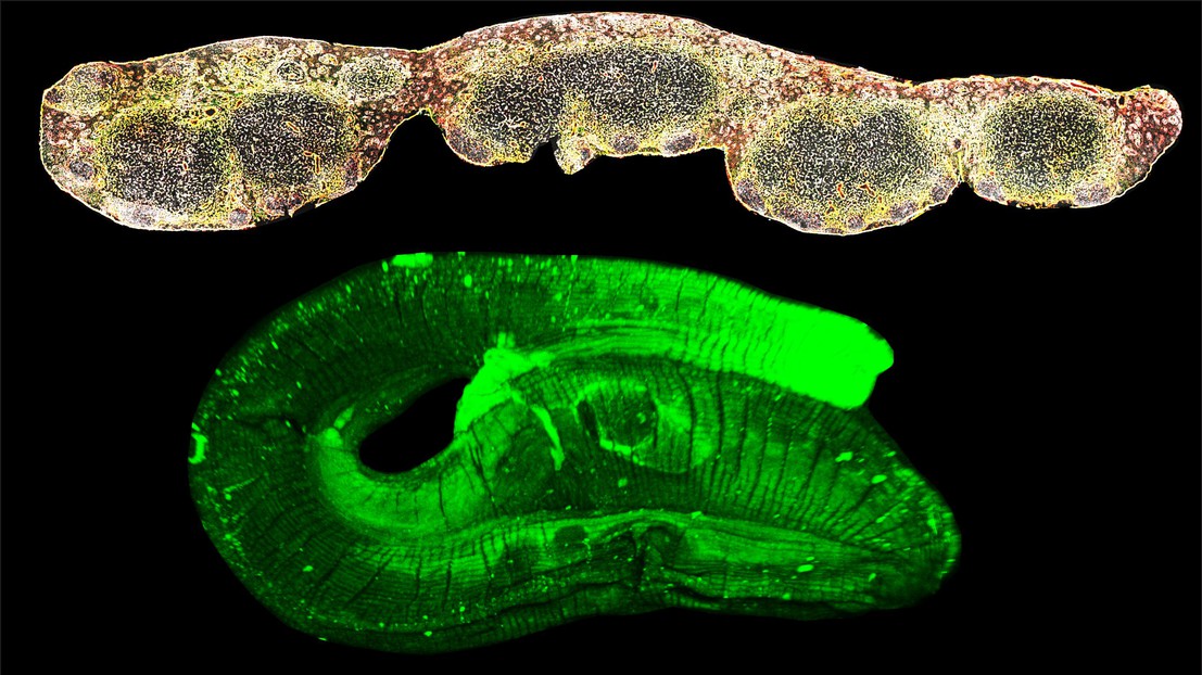 Lymph node follicles (top) and the intestinal worm Heligmosomoides polygyrus bakeri (bottom) © N. Harris (EPFL)