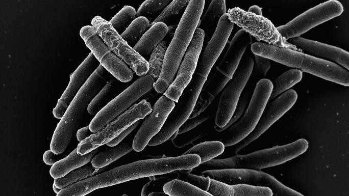 Mycobacterium smegmatis © J. McKinney/EPFL