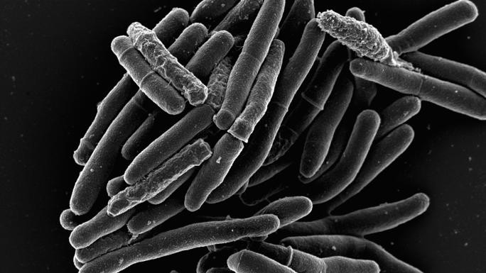 Микобактерии палочка. Mycobacterium smegmatis. Палочка Коха (Mycobacterium tuberculosis). Бацилла Коха под микроскопом. Бактерия Коха под микроскопом.